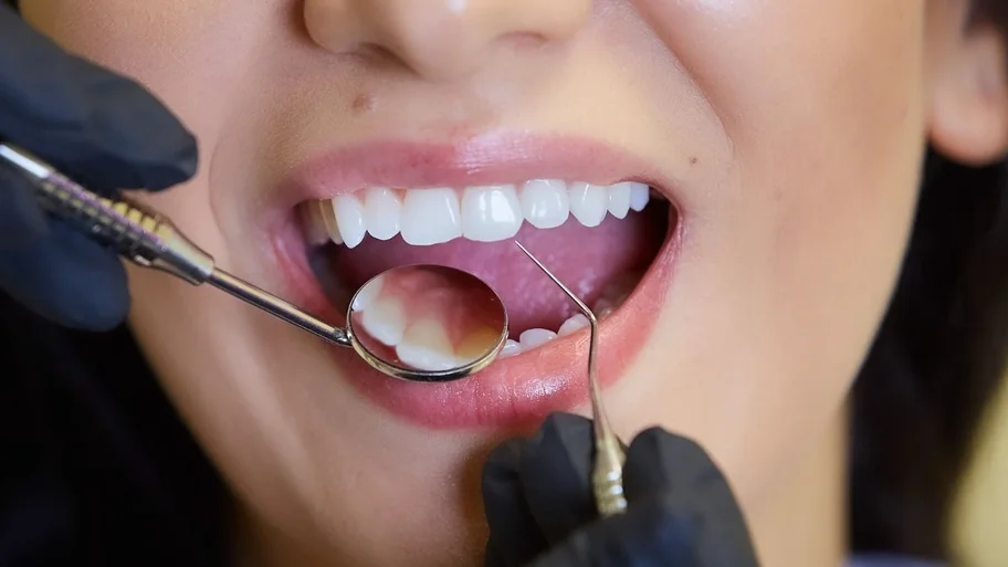 Revisão com espelho intraoral