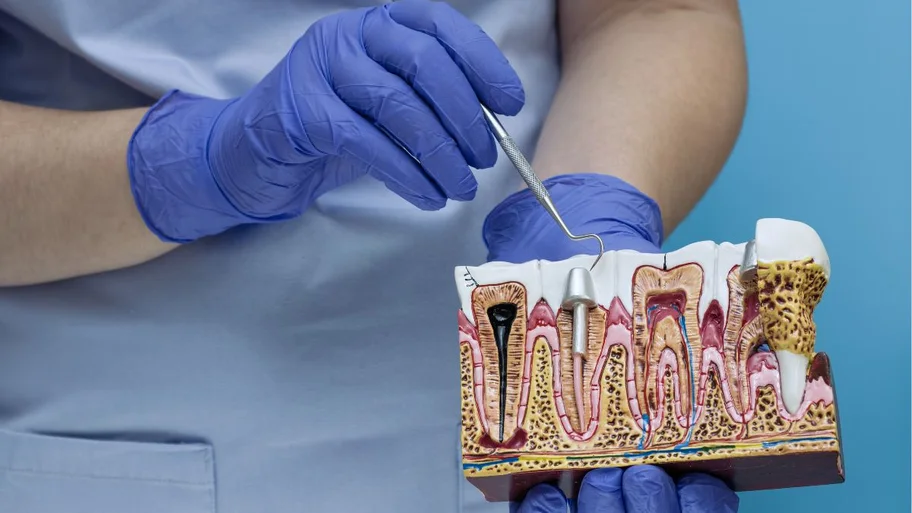 Modelo anatômico do periodonto