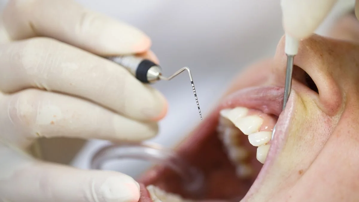 Sondaje periodontal en primer plano durante una revisión